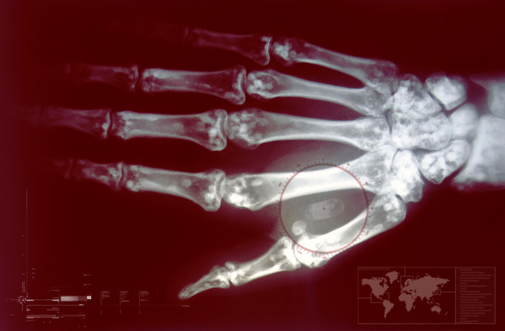 Cómo funcionan los microchips que se implantan bajo la piel para pagar
